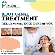 Root Canal Treatment Gurgaon