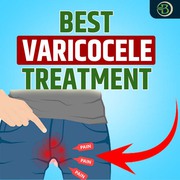 Natural treatment of varicocele problem