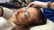 Fractional Co2 Laser